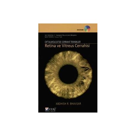 Oftalmolojide Cerrahi Teknikler Retina ve Vitreus Cerrahisi