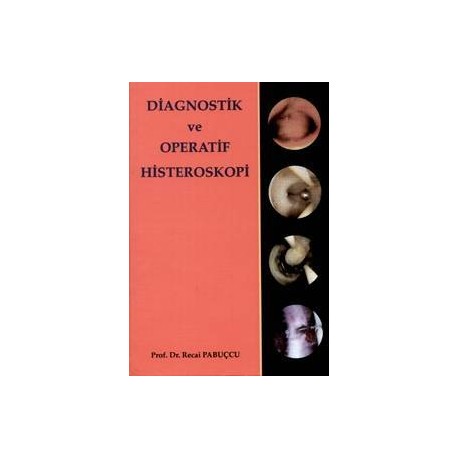Diagnostik ve Operatif Histeroskopi