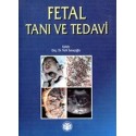 Fetal Tanı ve Tedavi