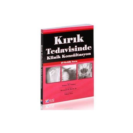 Kırık Tedavisinde Klinik Konsültasyon 49 Kritik Soru