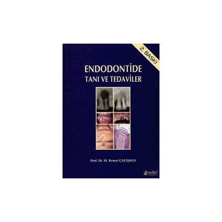 Endodontide Tanı ve Tedaviler