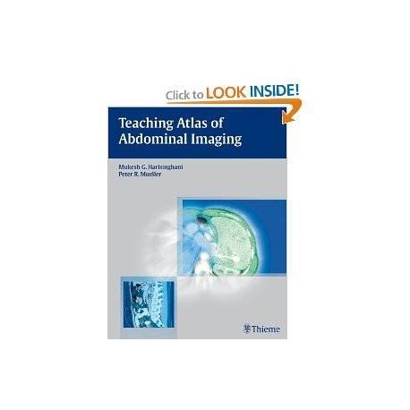 Teaching Atlas of Abdominal Imaging