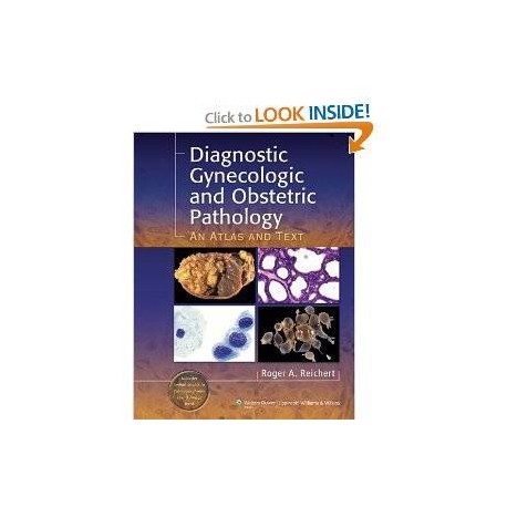 Diagnostic Gynecologic and Obstetric Pathology: An Atlas and Text