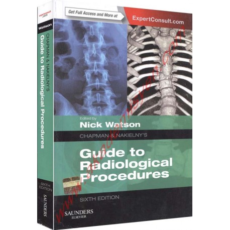 Chapman & Nakielny's Guide to Radiological Procedures: Expert Consult - Online and Print, 6e