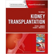 KİDNEY TRANSPLANTATİON - PRİNCİPLES AND PRACTİCE: EXPERT CONSULT - ONLİNE AND PRİNT, 7E