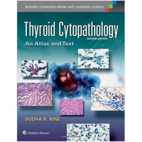 Thyroid Cytopathology: An Atlas and Text Second Edition