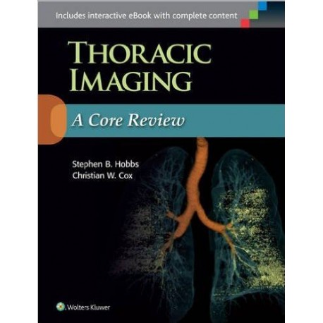 Thoracic Imaging: A Core Review First, Revised Reprint Edition