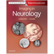 Imaging in Neurology, 1e 1 Har/Psc Edition