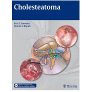 Cholesteatoma (Hardcover)