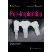 Peri-implantitis