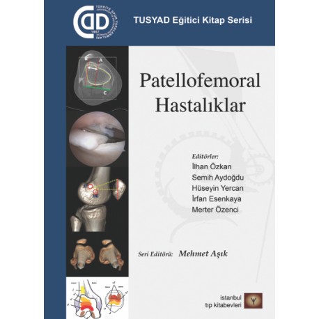 Patellofemoral Hastalıklar