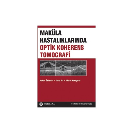 Maküla Hastalıklarında Optik Koherens Tomografi