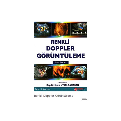 Renkli Doppler Görüntüleme