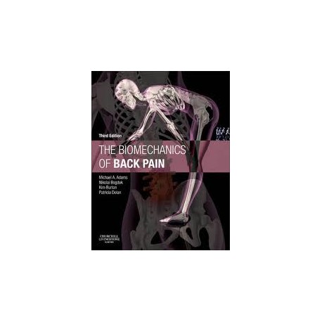 The Biomechanics of Back Pain