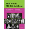 Tüm Vücut MR Görüntüleme