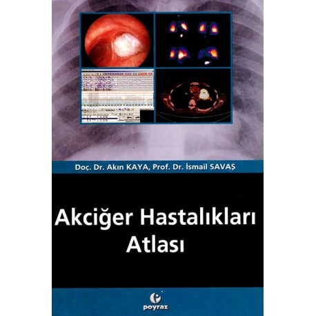 Akciğer Hastalıkları Atlası