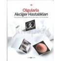 Olgularla Akciğer Hastalıkları