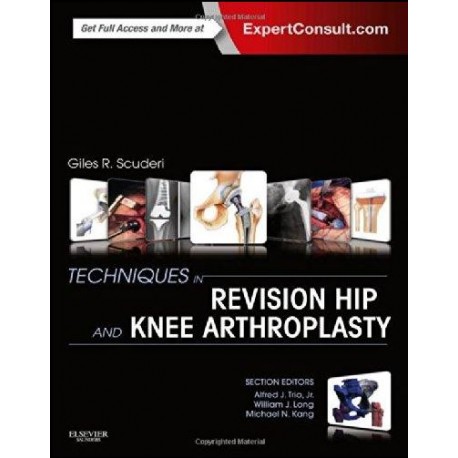 Techniques in Revision Hip and Knee Arthroplasty, 1e