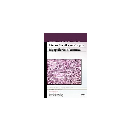 Uterus Serviks ve Korpus Biyopsilerinin Yorumu Biyopsi Yorumları Serisi