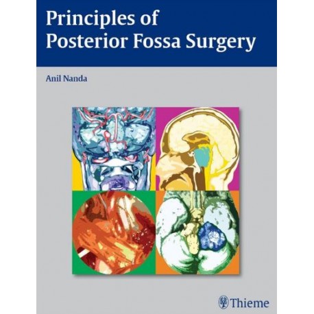 Principles of Posterior Fossa Surgery 1st Edition