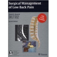 Surgical Management of Low Back Pain: 2nd Edition