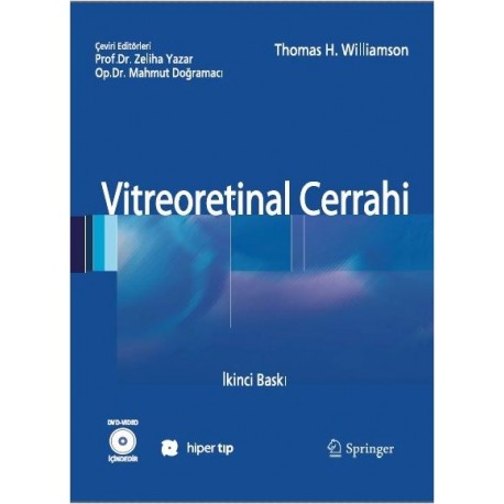 Vitreoretinal Cerrahi