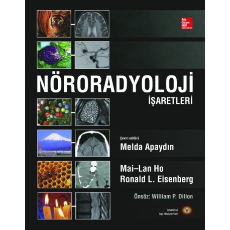 Nöroradyoloji İşaretleri