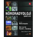 Nöroradyoloji İşaretleri