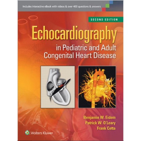 Echocardiography in Pediatric and Adult Congenital Heart Disease Hardcover