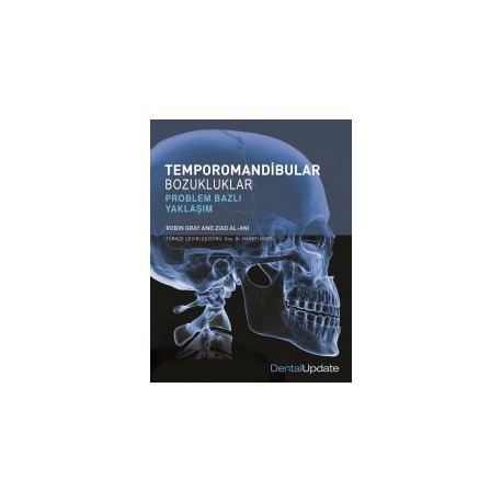 Temporomandibular Bozukluklar