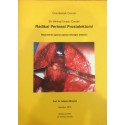 Bir Minimal İnvaziv Cerrahi Radikal Perineal Prostatektomi