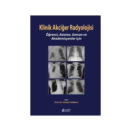 Klinik Akciğer Radyolojisi: Öğrenci, Asistan, Uzman ve Akademisyenler için