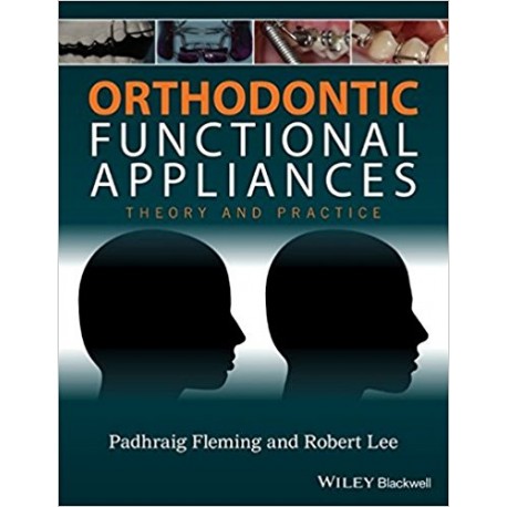 Orthodontic Functional Appliances: Theory and Practice 