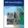 MR Neuroimaging: Brain, Spine, and Peripheral Nerves 1st Edition