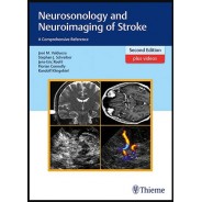 Neurosonology and Neuroimaging of Stroke: A Comprehensive Reference 2nd edition Edition