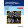 Neurosonology and Neuroimaging of Stroke: A Comprehensive Reference 2nd edition Edition