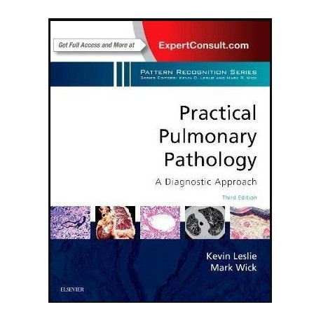 Practical Pulmonary Pathology: A Diagnostic Approach: A Volume in the Pattern Recognition Series