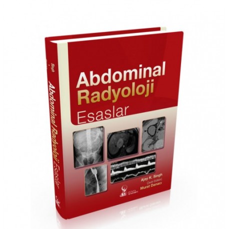 Abdominal radyolojinin esasları