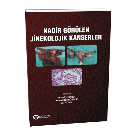 Nadir Görülen Jinekolojik Kanserler