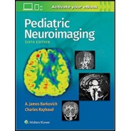 Pediatric Neuroimaging