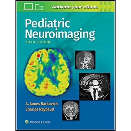 Pediatric Neuroimaging