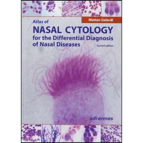 Atlas of Nasal Cytology for the Differential Diagnosis of Nasal Diseases Hardcover