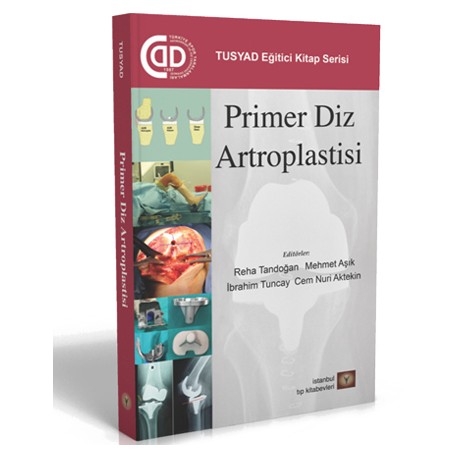 Primer Diz Artroplastisi