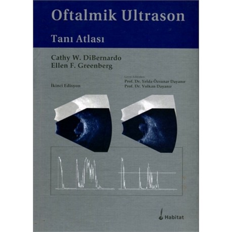 Oftalmik Ultrason