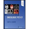 Fundamentals of Oncologic PET/CT 