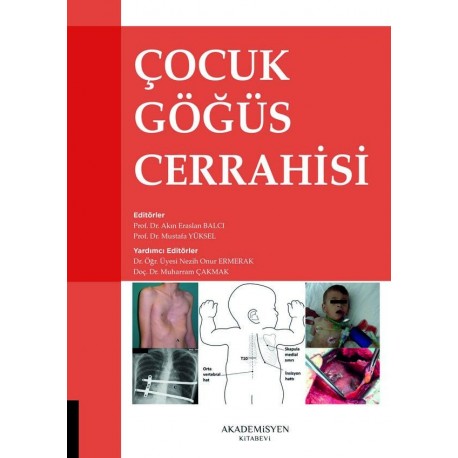 Çocuk Göğüs Cerrahisi