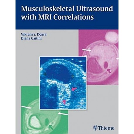 Musculoskeletal Ultrasound with MRI Correlations 