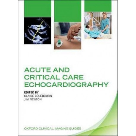 Acute and Critical Care Echocardiography