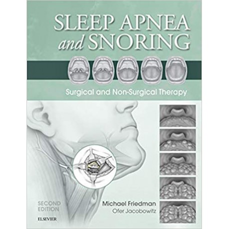 Sleep Apnea and Snoring: Surgical and Non-Surgical Therapy