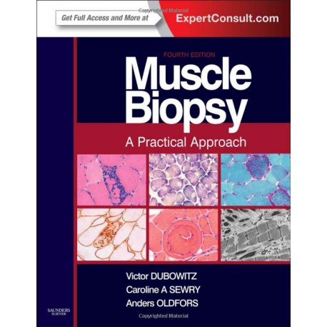 Muscle Biopsy: A Practical Approach